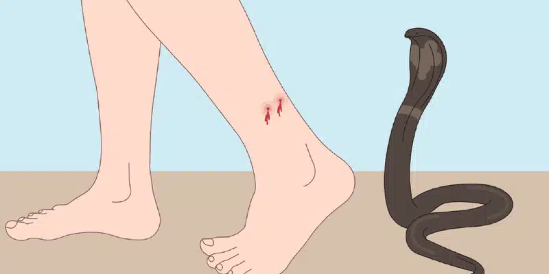 bi ran can chan nhung dieu nen va khong nen lam 1 58cfe777ca