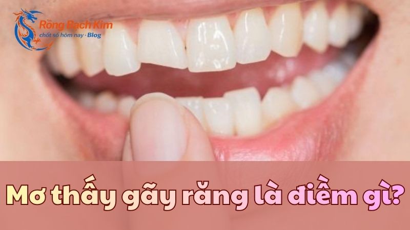 Giải mã giấc mơ thấy gãy răng chi tiết, hấp dẫn nhất 1 mơ thấy gãy răng