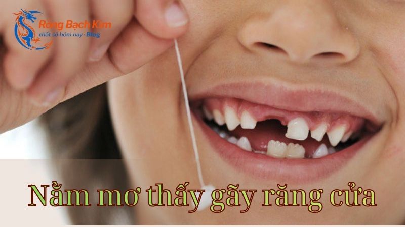 Giải mã giấc mơ thấy gãy răng chi tiết, hấp dẫn nhất 2 mơ thấy gãy răng