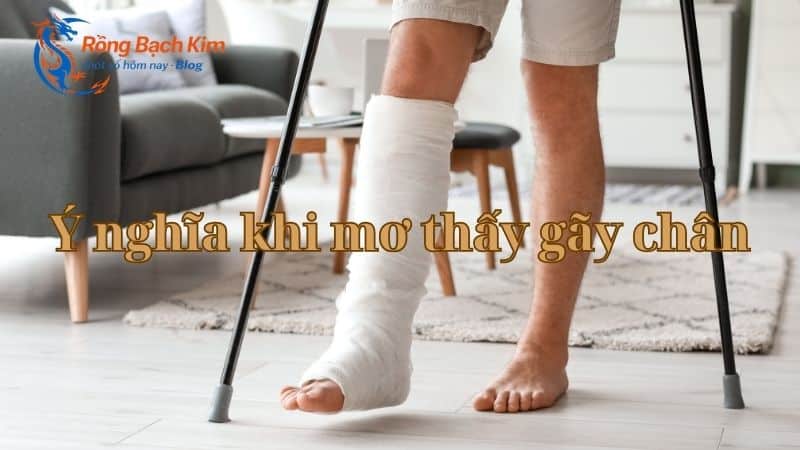 mơ thấy gãy chân