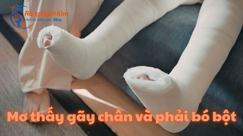 mơ thấy gãy chân