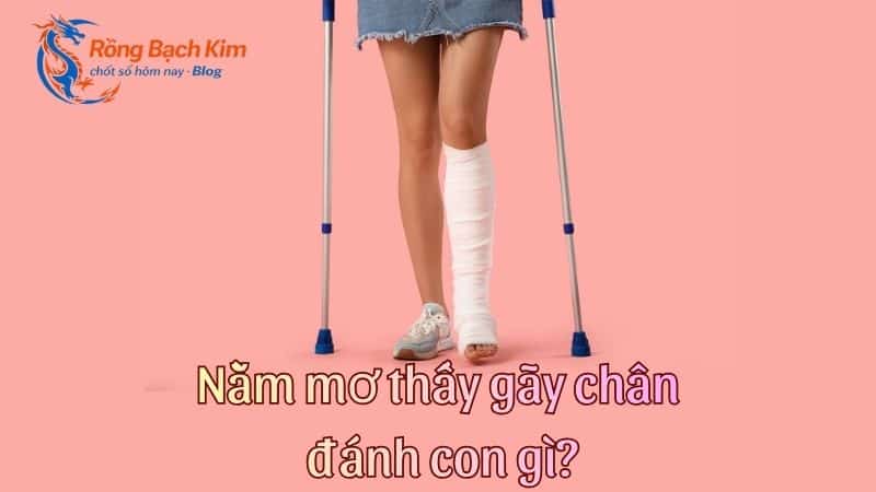 mơ thấy gãy chân